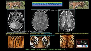 RECAP SERIES TIGERS IN RADIOLOGY [upl. by Rennane976]