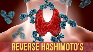 Hashimotos Thyroiditis The Truth About Reverse Hashimotos [upl. by Stranger]