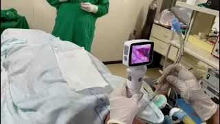 Postman video laryngoscope for airway intubation [upl. by O'Brien]