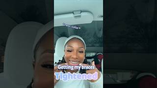 My Adult Braces Tightening Experience 😁braces bracesjourney [upl. by Leeland]