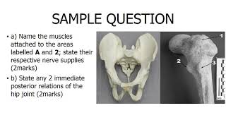 Gluteal region anatomy Anatomy revision with questions and answers [upl. by Mohn]