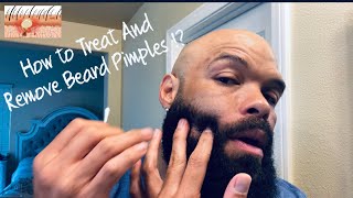 Ingrown Hair vs Beard Pimples  How To Treat and Remove Beard Pimples [upl. by Annahsar324]