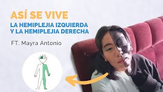 Diferencias entre la hemiplejia izquierda y hemiplejia derecha Explicado con EJEMPLOS [upl. by Blood]