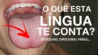 ESTUDO DA LÍNGUA  Petéquias e Fragilidade Emocional [upl. by Elagiba239]