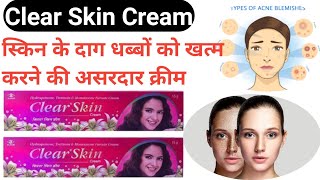 Clear skin cream  Clear skin cream uses in Hindi  मेलाज्मा के इलाज के लिए  shorts [upl. by Assilanna]