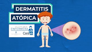 Cuidados en dermatitis atópica [upl. by Carnahan]