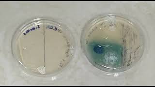 Prueba oxidasa en Pseudomonas aeruginosa [upl. by Ole602]