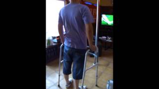 Paraplejia camina Paraplegia walk Lesion Medular 截瘫 Congénita [upl. by Heeley]