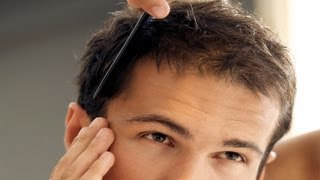 How to Treat Balding Hair  Thinning Hair [upl. by Odilia131]