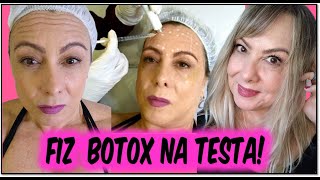 📢FIZ BOTOX NA TESTA l MEU ANTES E DEPOIS l DOEU QUAL FOI O RESULTADO [upl. by Nellad]