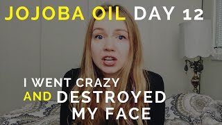 I Went Crazy And Destroyed My Face  Jojoba Oil On AcneProne Skin [upl. by Llerraj271]