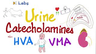 Catecholamines Epinephrine NoEpinephrine Dopamine Metanephrines HVA VMA  Pheochromocytoma [upl. by Aihsenad]