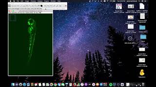 ImageJ Tutorial [upl. by Edd]