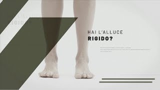 Hai lAlluce Rigido [upl. by Agemo]