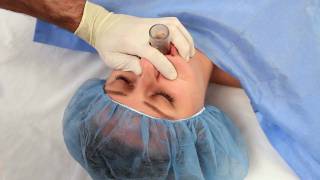 NuMask in Anesthesiology IntraOral Mask IOM®  Oropharyngeal Airway OPA Training Video [upl. by Festus]