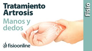 Tratamiento de fisioterapia para la artrosis de manos y dedos [upl. by Estus]