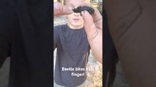 Horned beetle bites finger OUCH beetle ouch bugs [upl. by Bolen]