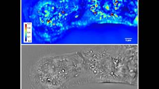 Heart Cells cardiomyocytesBeating [upl. by Ecirum]