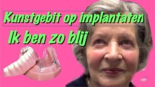 Kunstgebit op implantatenhet klikgebit gemaakt in Amsterdam Zuidoost [upl. by Nicolas]