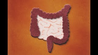 Patología Isquémica Intestinal Definición Evaluación Tratamiento [upl. by Olpe]