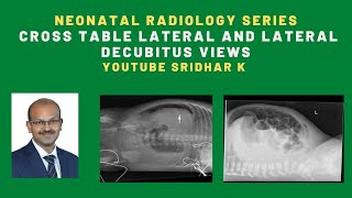 Neonatal radiology serieswhen do we use cross table lateral view and lateral decubitus view xray [upl. by Gaivn]