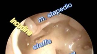 Anatomia dellorecchio medio [upl. by Ytte]