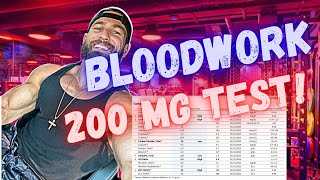 WHAT TO EXPECT ON 200 mg TESTOSTERONE per week  Bloodwork and How I feel after 4 months on 200mg [upl. by Karilla]