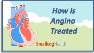 How is Angina Treated [upl. by Erasmo]