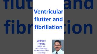 Ventricular flutter and fibrillation [upl. by Dickerson444]