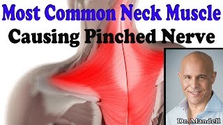 Most Common Neck Muscle That Causes Pinched Nerve  Dr Alan Mandell DC [upl. by Ettari]