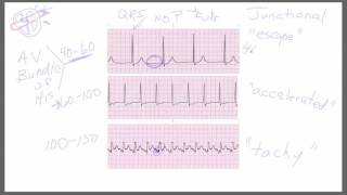 Junctional Rhythms [upl. by Apostles]