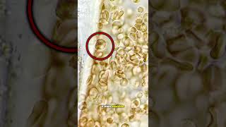 White blood cells ATTACK giant parasite worm [upl. by Nabila]