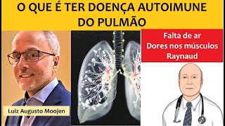 O que é ter doença autoimune do pulmão Fibrose pulmonar [upl. by Wilda]