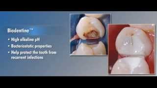 Biodentine Dentrek Module [upl. by Estrellita515]