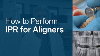 How to Perform IPR for Reveal® Clear Aligners [upl. by Myles50]