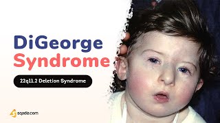 DiGeorge Syndrome Pathophysiology  2Minute Neurology Video  VLearning™ [upl. by Grishilda]