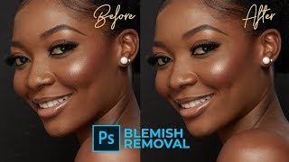 How to Remove Blemishes in Photoshop Easy [upl. by Redle]