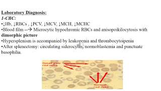 Protoporphyrin disorders [upl. by Nilram]