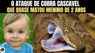 O Ataque de Cobra Cascavel que quase matou menino de 2 anos  Biólogo Henrique o Biólogo das Cobras [upl. by Lindon]