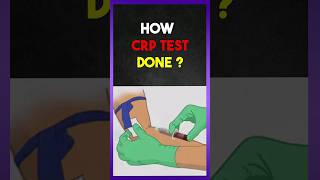 How CRP  Creactive protein  test done [upl. by Rediah]