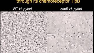 Helicobacter pylori Senses Urea as an Attractant through Its Chemoreceptor TlpB [upl. by Yroc94]