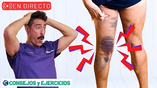 🔴 Mi experiencia con Roturas musculares  ejercicios y consejos 🔴 V [upl. by Jael]