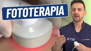 COMO APLICAR FOTOTERAPIA  DR JOÃO TASSINARY [upl. by Enialb]