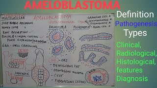 Ameloblastoma  Definition pathogenesis types clinical radiological features and diagnosis [upl. by Dinsmore]