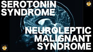 Serotonin Syndrome vs Neuroleptic Malignant Syndrome [upl. by Acire745]