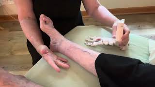 Part 1Hammer Toe Metatarsalgia BunionsMyofascial Treatment Solutions [upl. by Reizarf]