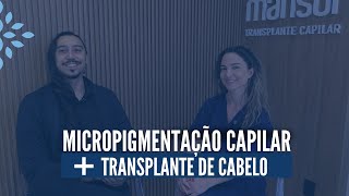 Micropigmentação capilar  Transplante Capilar transplantecapilarfue micropigmentaçãocapilar [upl. by Otsirc]