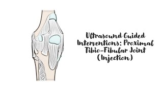 ultrasound Guided Interventions Proximal TibioFibular Joint Imaging [upl. by Strauss]