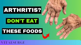 9 Foods To Avoid for Arthritis Stop Now [upl. by Etnovert626]