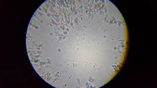 Lactobacillus acidophilus  Лактобацилус ацидофилус Narine [upl. by Ailemrac262]